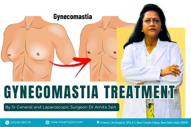Best Doctor and Surgeon for Gynecomastia Dr Amita Jain Best Doctor and Surgeon for Gynecomastia Dr Amita Jain